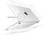 Screenguard MacBook Air 13 M1 Hard Case Hülle Glitzer clear hochglanz